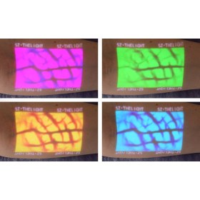 Συσκευή απεικόνισης φλεβών Enmind VV-100