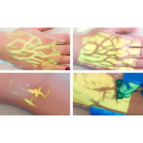 Συσκευή απεικόνισης φλεβών Enmind VV-100