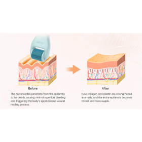 Bio roller G10 facial massage roller 10 in 1 micro needle derma roller