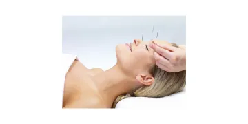 Acupuncture and Alternative Therapies