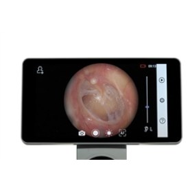 Otoscope with screen Riester RCS-100 - 