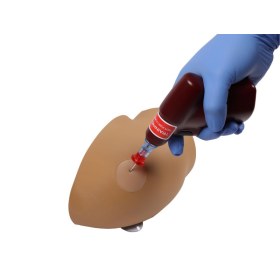 Πρόπλασμα ενδοοστικής έγχυσης χεριού AMY 7780