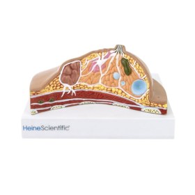 Πρόπλασμα εξέτασης στήθους - 