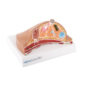 Πρόπλασμα εξέτασης στήθους - 