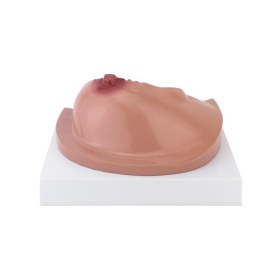 Πρόπλασμα εξέτασης στήθους