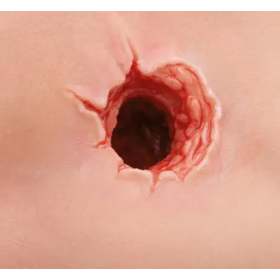 Training simulator for Bleeding Control - Kit P102