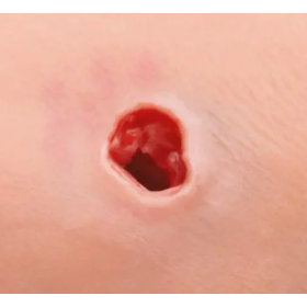 Training simulator for Bleeding Control - Kit P102