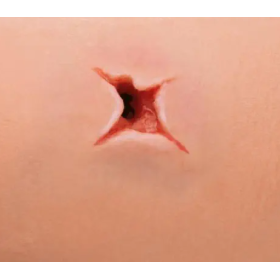 Training simulator for Bleeding Control - Kit P102