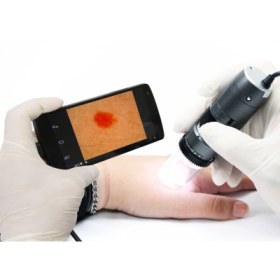 Dino-lite DermaScope Polarizer MEDL4DW - 