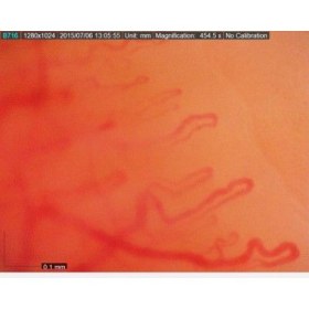 CapillaryScope DINOLITE PRO 500 MEDL4N5 - Dinolite Capillaroscope 200 pro MEDL4N