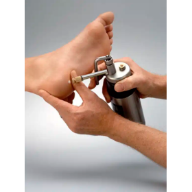 CryoPro cryosurgery unit with spray tips & cleaning adapter | Mini-300ml