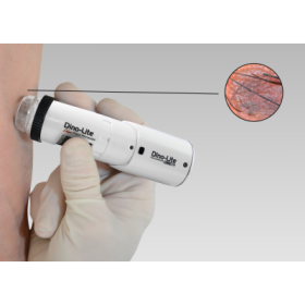 Wireless Dermatoscope Dinolite MEDLW4DW  - Wireless Dermatoscope MEDLW4E Dinolite