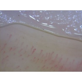 Wireless CapillaryScope 200 PRO Dinolite MEDLW4N  - CapillaryScope DINOLITE PRO 200 MEDLW4N 