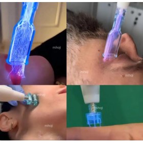 Συσκευή αισθητικής FUSION PLASMA για περιποίηση δέρματος και τριχωτού της κεφαλής - 