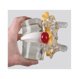 Πρόπλασμα εξομοίωσης δισκοκήλης 4400 - 