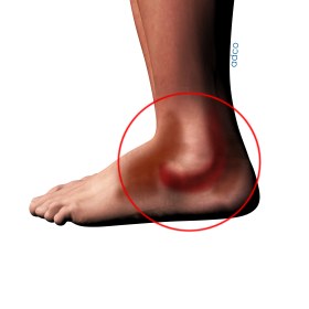 Πόδι - αστράγαλος