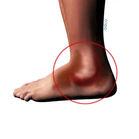 Πόδι - αστράγαλος