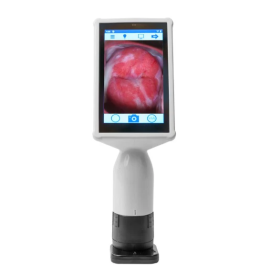 Ψηφιακό κολποσκόπιο Eva PRO Mobileotd