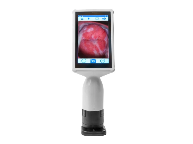 Eva PRO Mobileotd smart digital colposcopy Eva PRO Mobileotd smart digital colposcopy