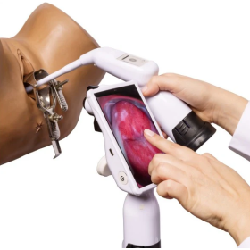 Ψηφιακό κολποσκόπιο Eva PRO Mobileotd