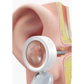Video otoscope Q10