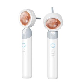Video otoscope Q10