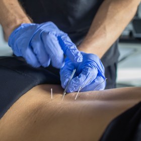 Acupuncture Needles with Guide Tube 100 pieces Yellow Sport - 