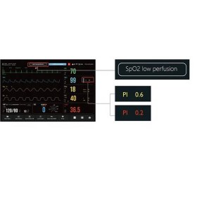 Monitor ασθενών AIVIEW VX