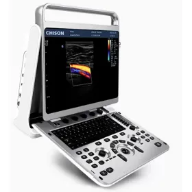 Φορητός υπέρηχος CHISON Ebit20