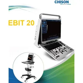 Φορητός υπέρηχος CHISON Ebit20 - 