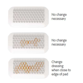 Επίθεμα Αδιάβροχο με Απορροφητικό Pad OpSite Post-Op Visible 1 τεμάχιο