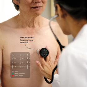 Eko CORE 500™ Digital Stethoscope | Black Edition(6)