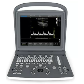 Chison ECO2 Portable Ultrasound - Chison ECO2 Portable Ultrasound(1)