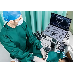 Φορητός Υπέρηχος CHISON SonoAir30 Laptop Type(5)