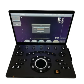 Φορητός Υπέρηχος CHISON SonoAir30 Laptop Type(3)